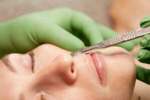 cleveland esthetician dermaplaning facial