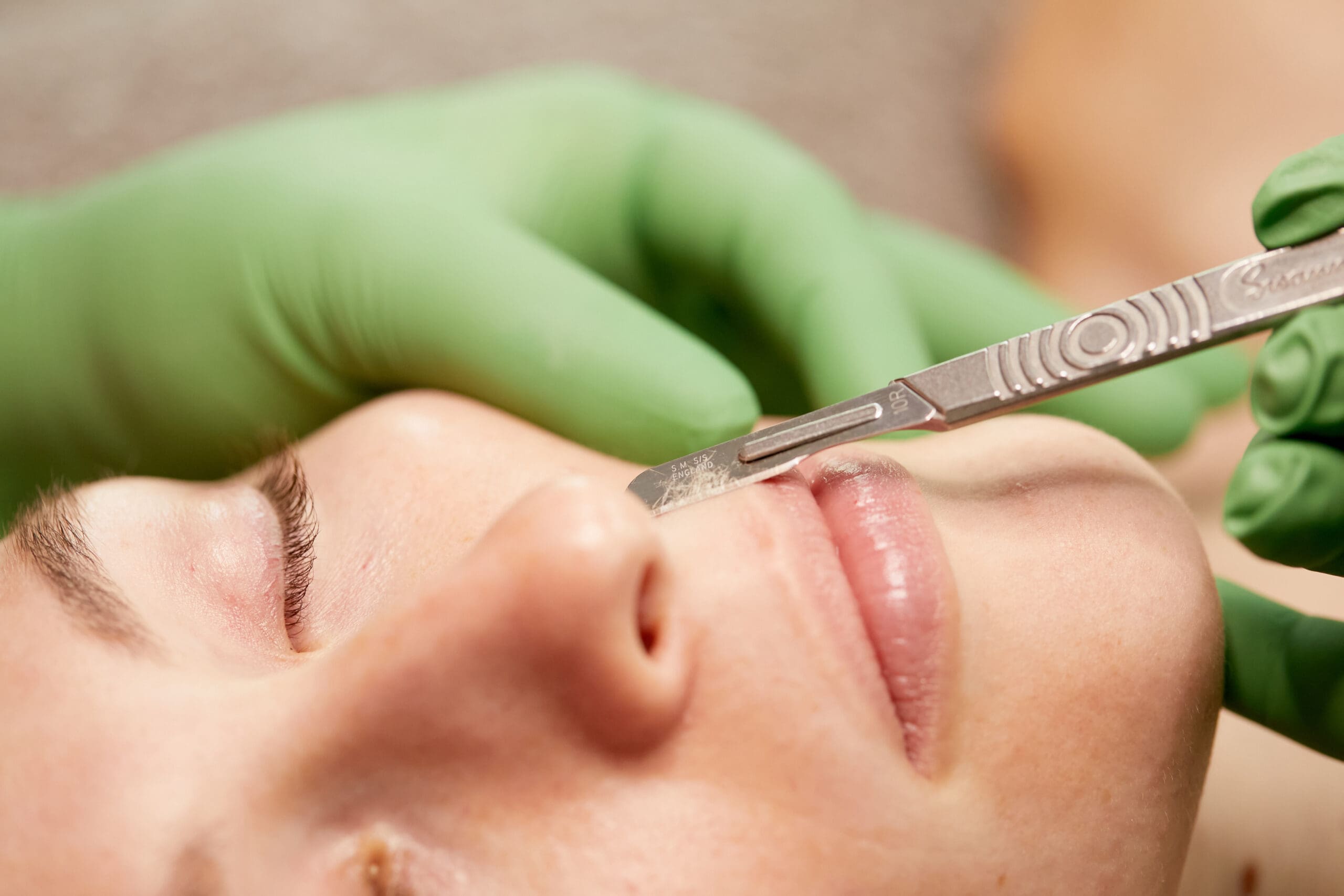 cleveland esthetician dermaplaning facial